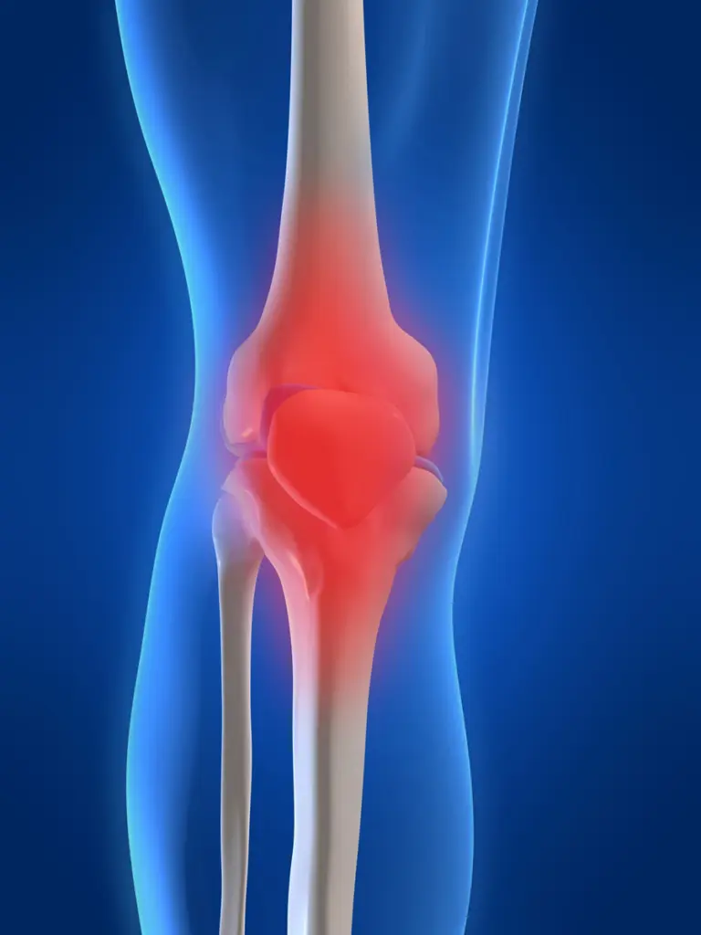 Osteoporosis